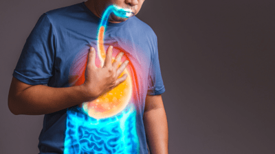 Doctor-recommended lifestyle changes to tackle acid reflux and GERD Doctor-recommended lifestyle changes to tackle acid reflux and GERD
