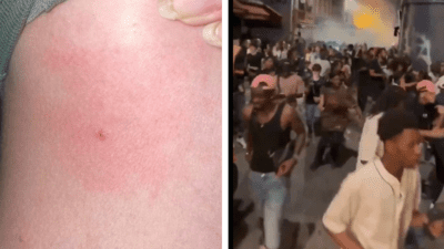 Watch: Chaos erupts at music festival in Paris after mysterious syringe attacks; over 100 injured Watch: Chaos erupts at music festival in Paris after mysterious syringe attacks; over 100 injured