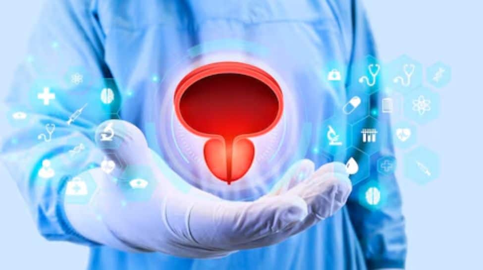 Bladder Cancer In India- Concerning Statistics And The Urgent Call For Action | Health News Bladder Cancer In India- Concerning Statistics And The Urgent Call For Action | Health News