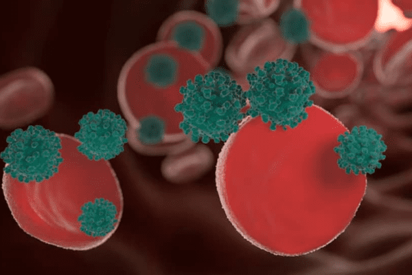 Doctor Warns: These 5 Silent Symptoms Could Be Early Signs Of Blood Cancer, Don’t Ignore Them! | Health News Doctor Warns: These 5 Silent Symptoms Could Be Early Signs Of Blood Cancer, Don’t Ignore Them! | Health News