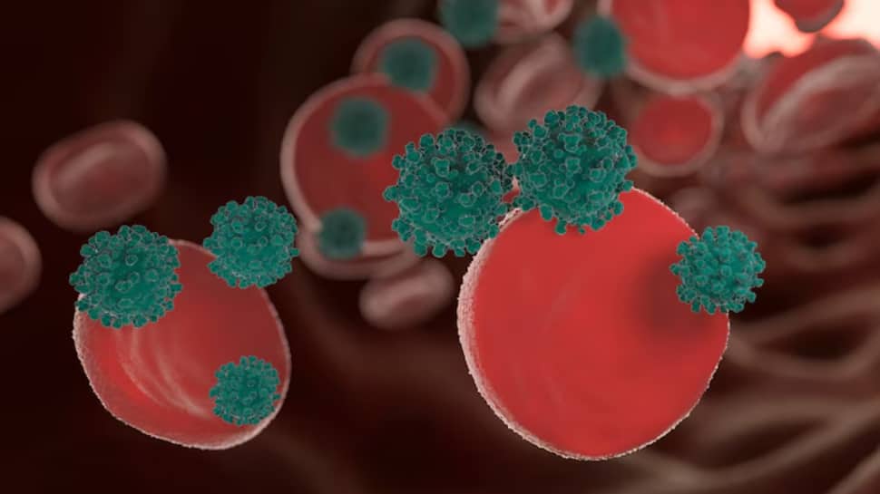 Doctor Warns: These 5 Silent Symptoms Could Be Early Signs Of Blood Cancer, Don’t Ignore Them! | Health News Doctor Warns: These 5 Silent Symptoms Could Be Early Signs Of Blood Cancer, Don’t Ignore Them! | Health News