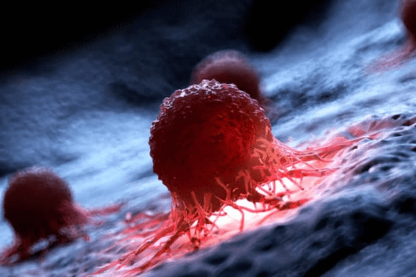 What Makes AML So Dangerous? Understanding One Of The Fastest-Growing And Hardest-To-Treat Blood Cancers | Health News