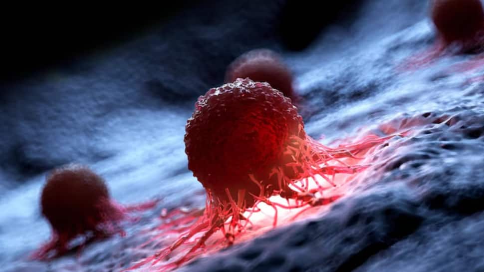 What Makes AML So Dangerous? Understanding One Of The Fastest-Growing And Hardest-To-Treat Blood Cancers | Health News What Makes AML So Dangerous? Understanding One Of The Fastest-Growing And Hardest-To-Treat Blood Cancers | Health News