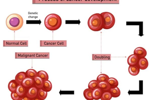 Acute Myeloid Leukemia: Expert Explains Why This Aggressive Blood Cancer Is Rising Fast In India | Health News Acute Myeloid Leukemia: Expert Explains Why This Aggressive Blood Cancer Is Rising Fast In India | Health News