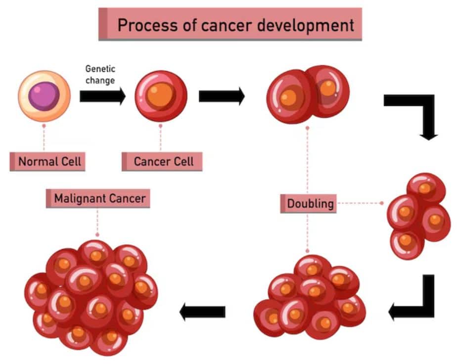 Acute Myeloid Leukemia: Expert Explains Why This Aggressive Blood Cancer Is Rising Fast In India | Health News