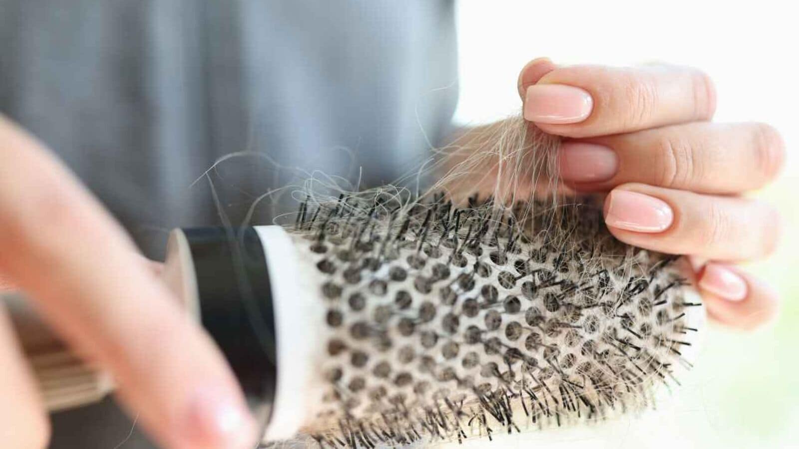 Hair loss isn’t just a man’s problem. Four ways to treat female baldness. Hair loss isn’t just a man’s problem. Four ways to treat female baldness.