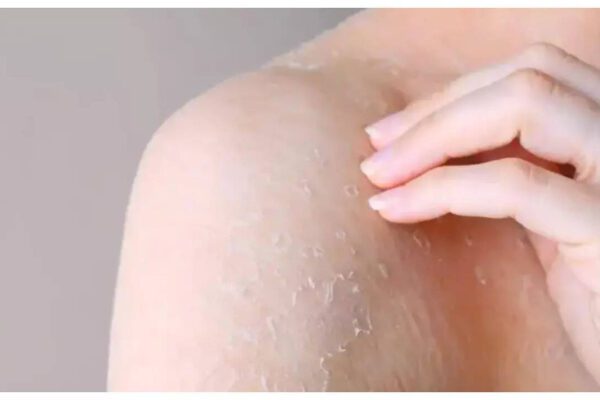 5 warning signs your skin is giving you 5 warning signs your skin is giving you