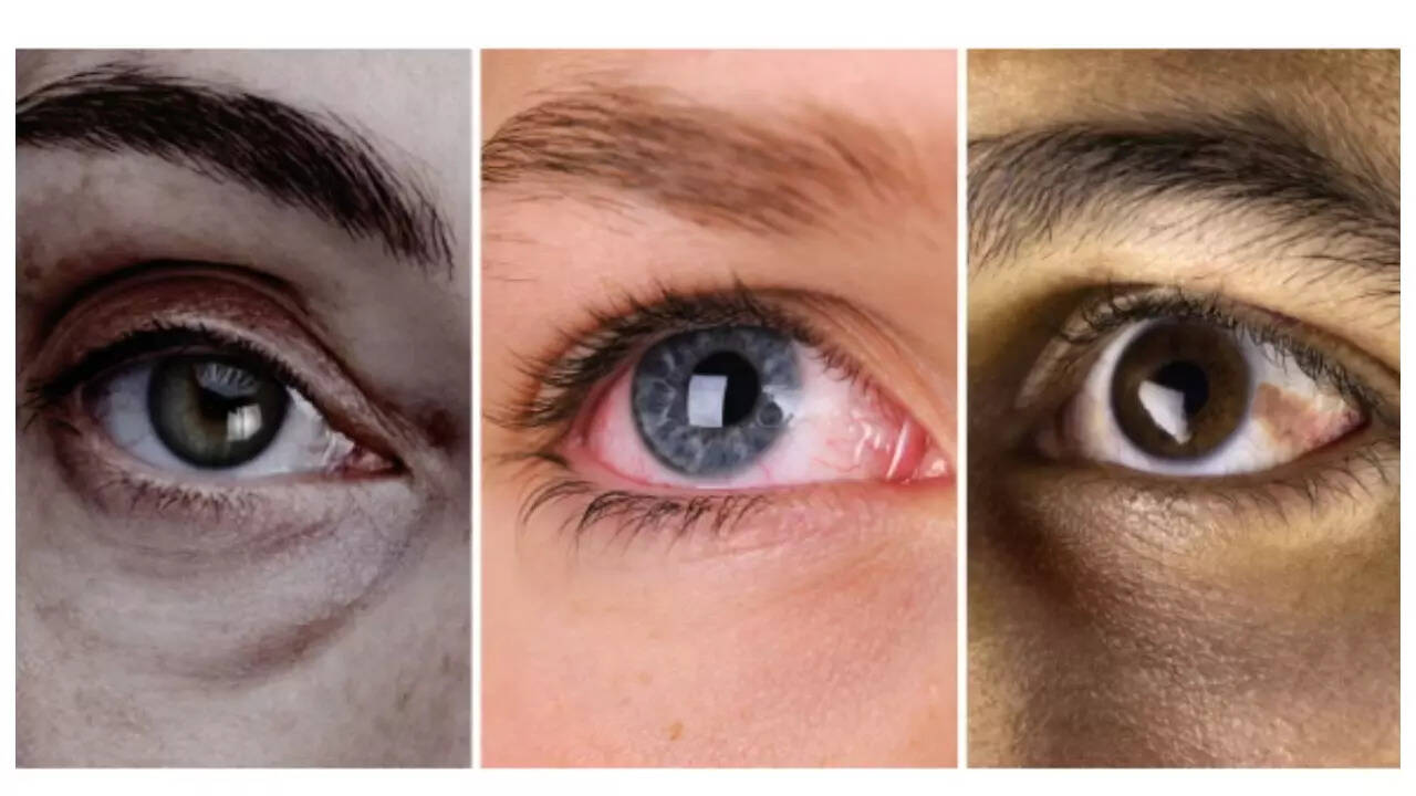 5 diseases that your eyes can reveal (and how to check for them) 5 diseases that your eyes can reveal (and how to check for them)