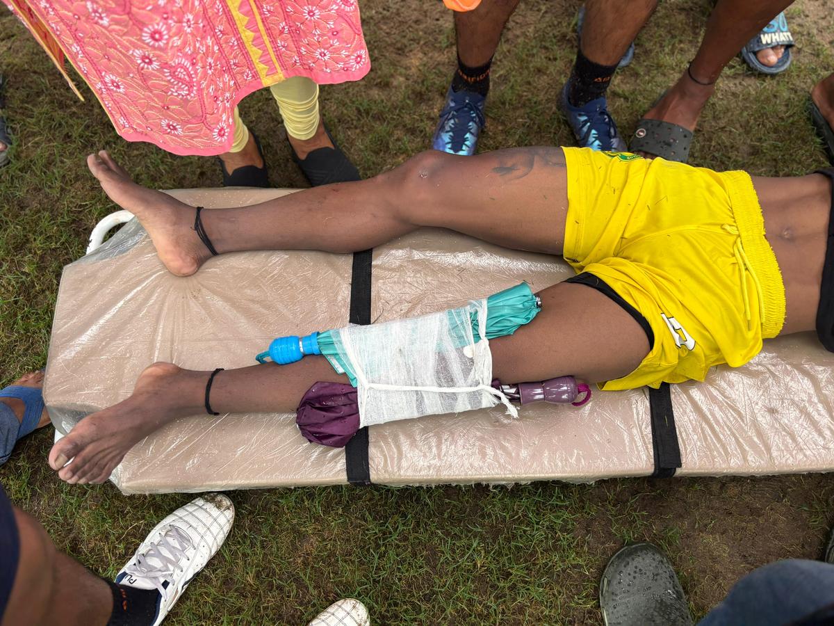Brawl erupts in Mohan Bagan vs Railways CFL clash, umbrellas used as braces in bizarre treatment